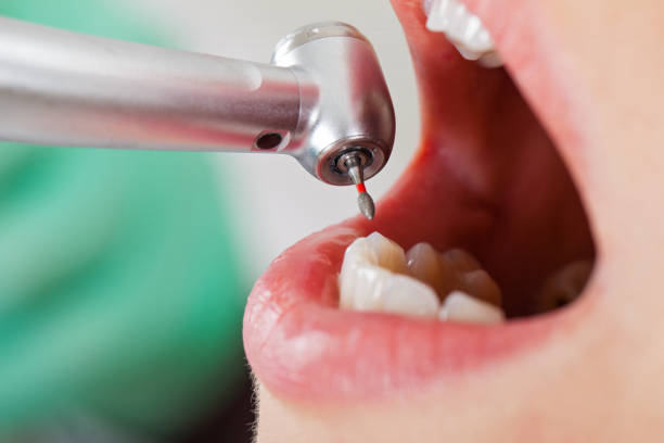 Best Emergency Care for Gum Disease in Stockton, IL